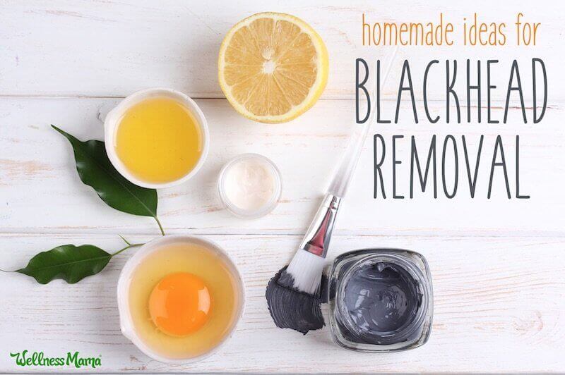 Homemade Blackhead Removal Ideas